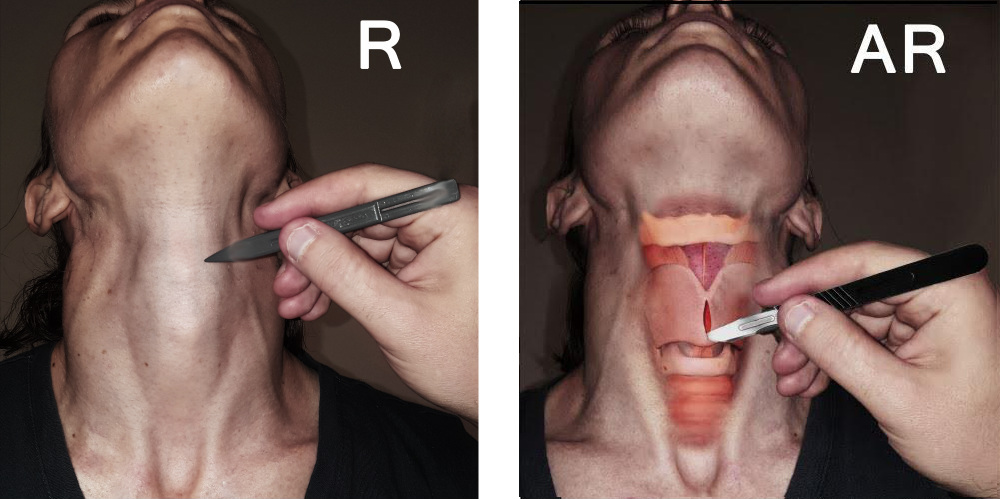 In ‘Crike’, Air Force trainees could see virtual anatomy superimposed on live standard patients. This GamesThatWork concept art shows the real scene and the augmented view with the player performing cricothyrotomy.